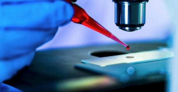 Brutale vertrouwensbreuk bij MDxHealth